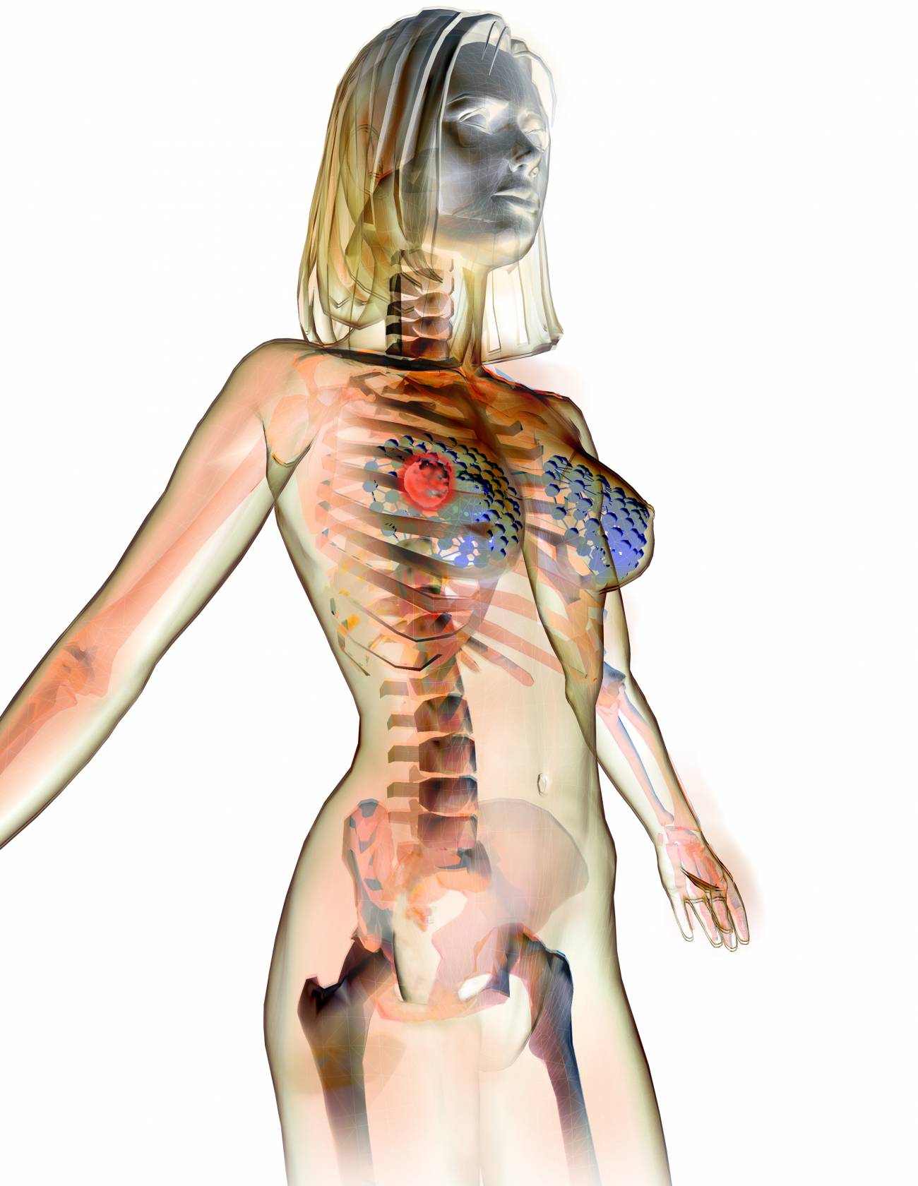 Descubren cómo la terapia de sustitución hormonal y la píldora causan cáncer de mama