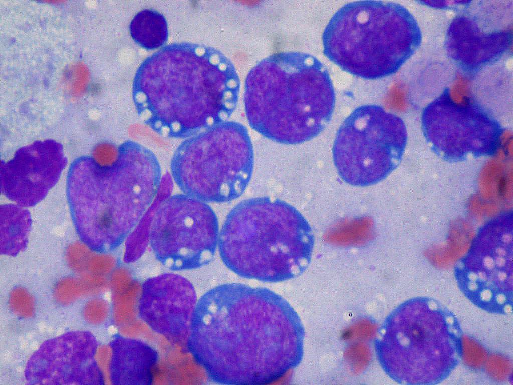 Descubren nuevas regiones genéticas activas en el cáncer