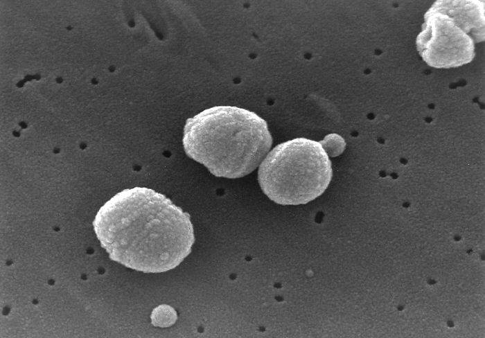 Desenmascaran una bacteria inmune a vacunas y antibióticos