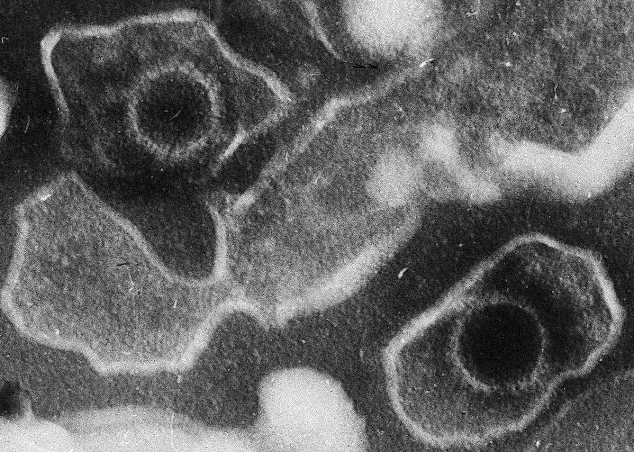 Desentrañan los secretos de un virus muy común que puede causar cáncer