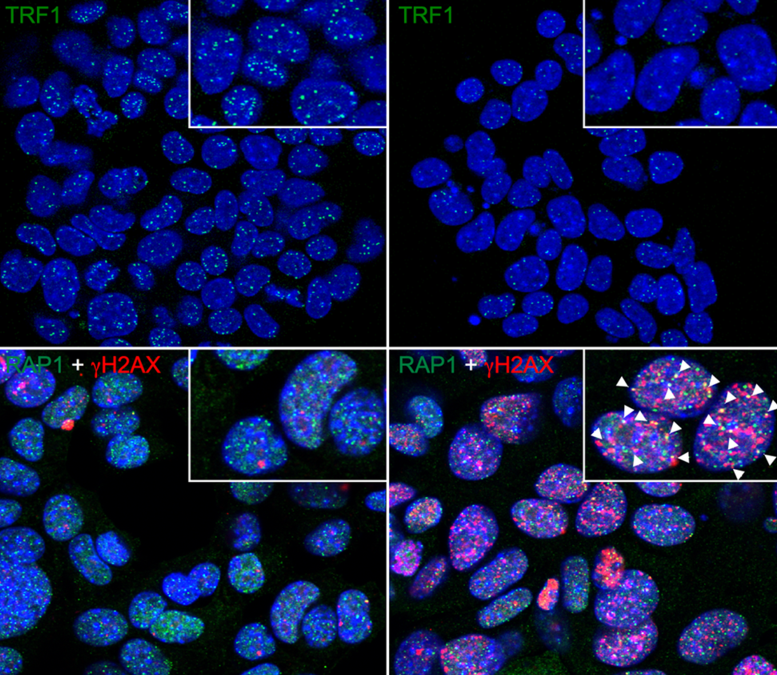 El cáncer deja de ser inmortal