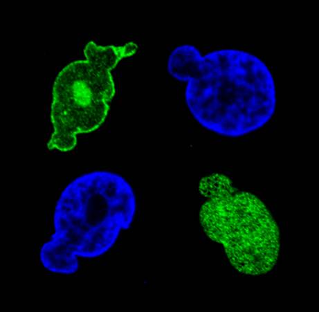 Identifican un gen que produce envejecimiento acelerado hereditario