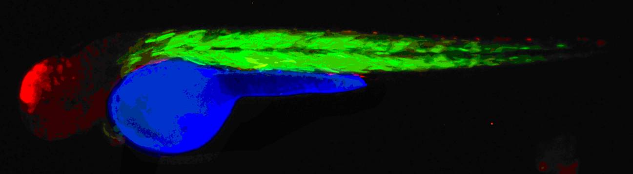 Identifican una de las causas de la predisposición genética a padecer cáncer de colon 