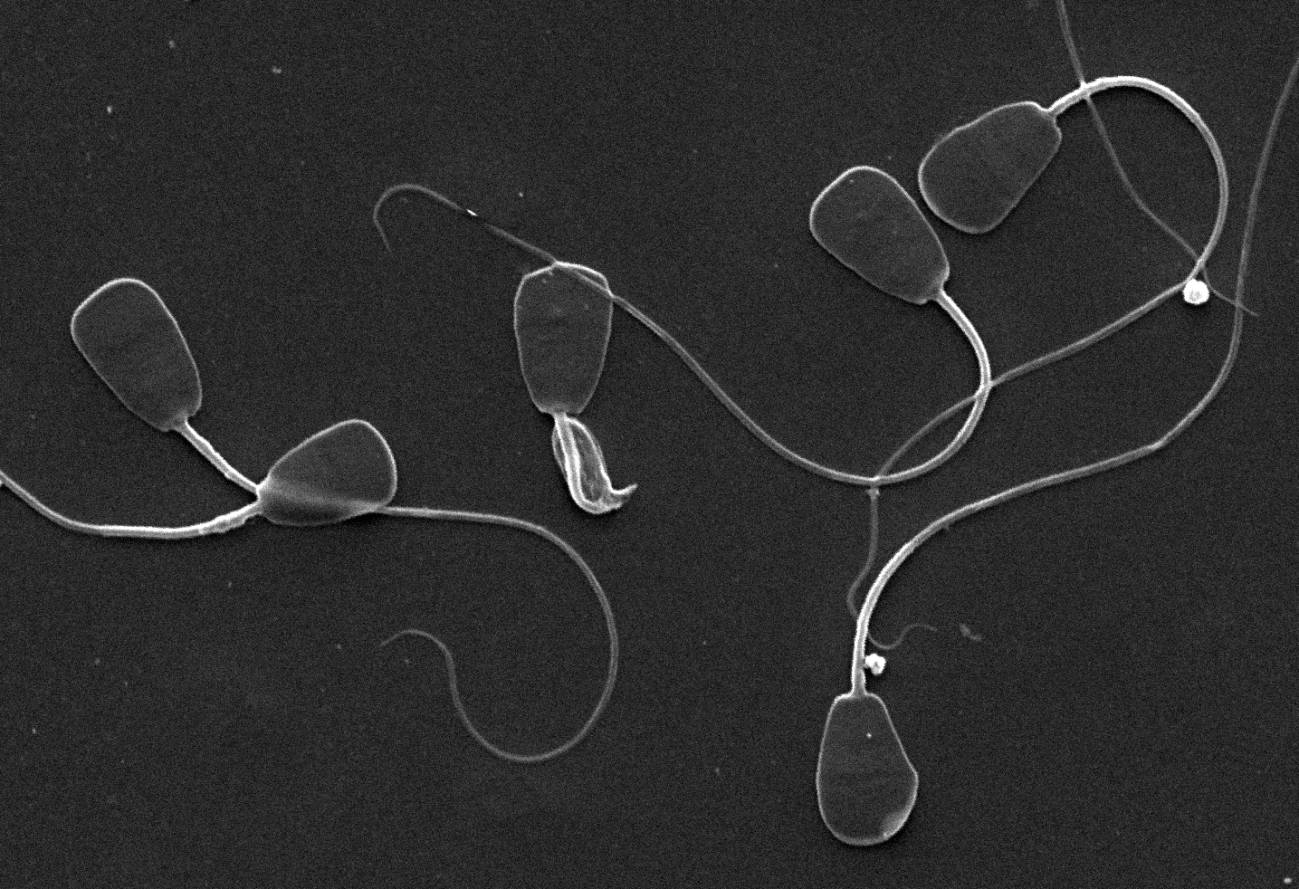 La consaguinidad aumenta el daño en el ADN de los espermatozoides