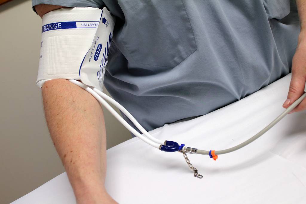 La hipertensión arterial (HTA) es un importante problema de salud pública. Imagen: Quinn.anya