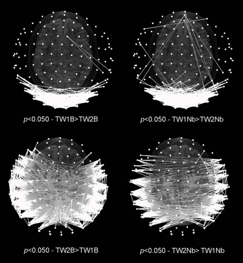 La dinámica de las redes cerebrales varía durante la apreciación de la belleza