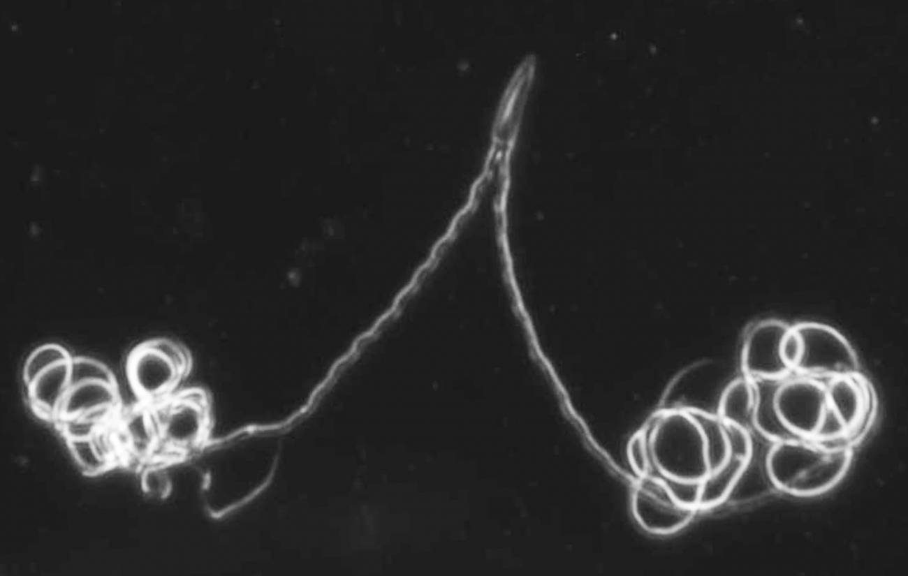 El esperma del escarabajo presenta una gran variedad de formas y estructuras. Imagen: Dawn Higginson/ Universidad de Arizona