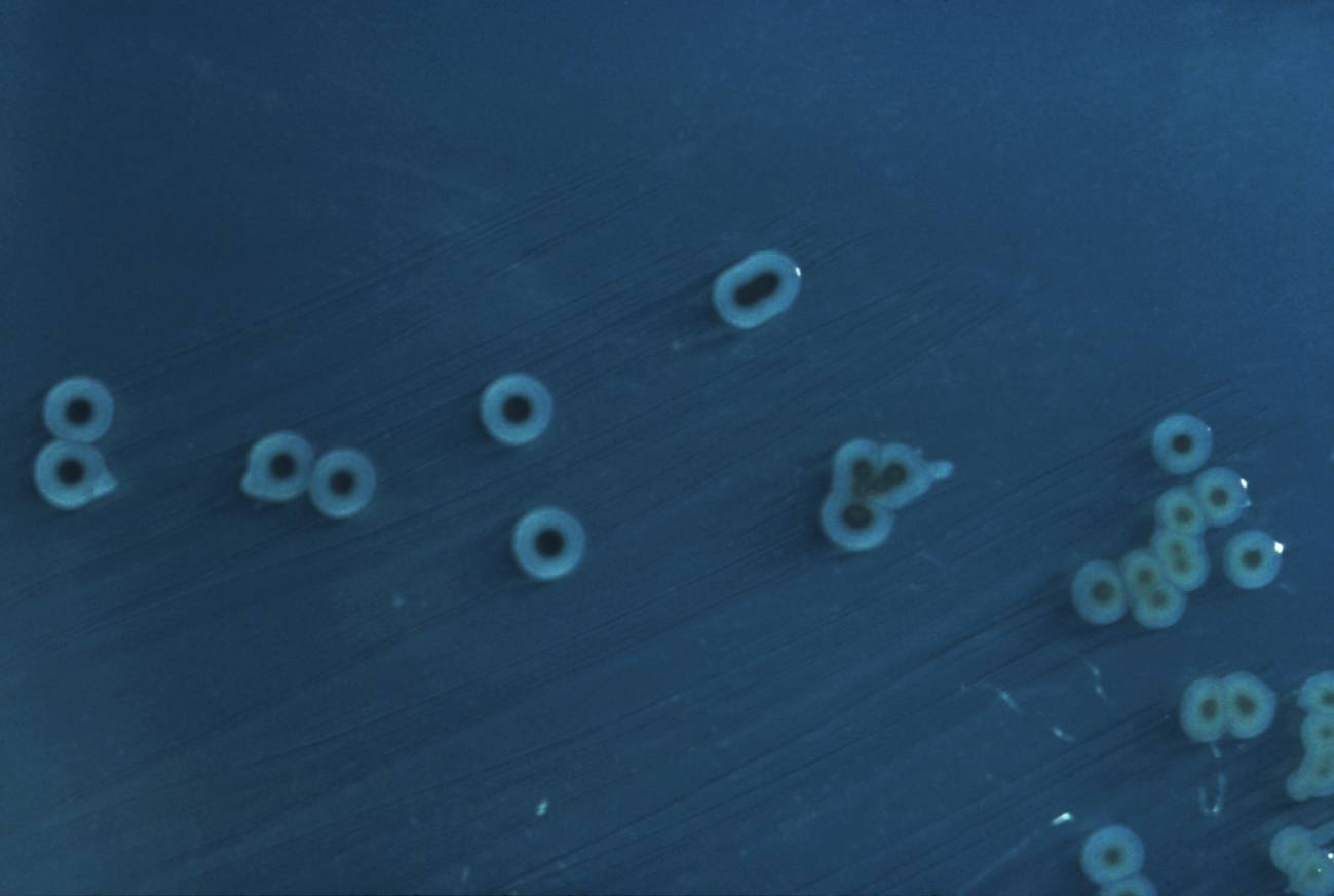 La infección de la bacteria causante de la salmonelosis depende del nivel del hierro de su entorno