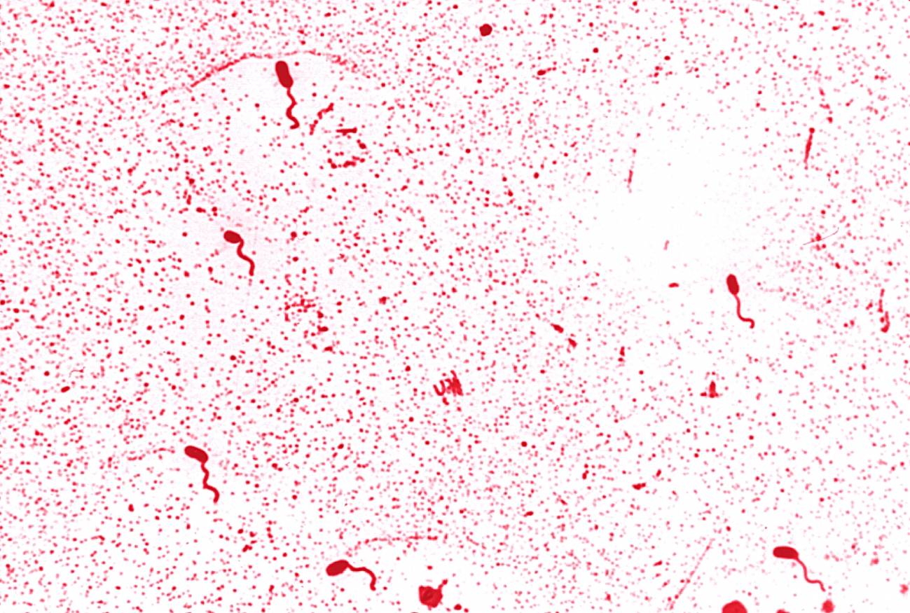 Bacterias marinas Vibrionaceae cholerae. Imagen: Wikipedia.  