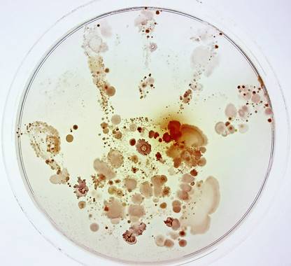 ¿Qué esconde la mano de un niño? De Raúl Rivas González. Couautora: Lorena Celador Lera. Primer premio categoría General de Fotciencia.