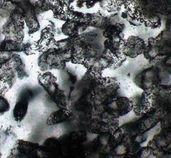 bacterias