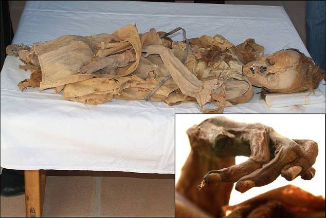 Aspecto general de la momia de Sancho de Castilla, vestida con un hábito de lino y un cíngulo de cuero. Los huesos de las piernas se encuentran desarticulados en el regazo. La hemicara izquierda estaba muy bien conservada, reconociéndose incluso el párpado y las pestañas. También conservaba gran parte del cuero cabelludo. Imagen: UCM.