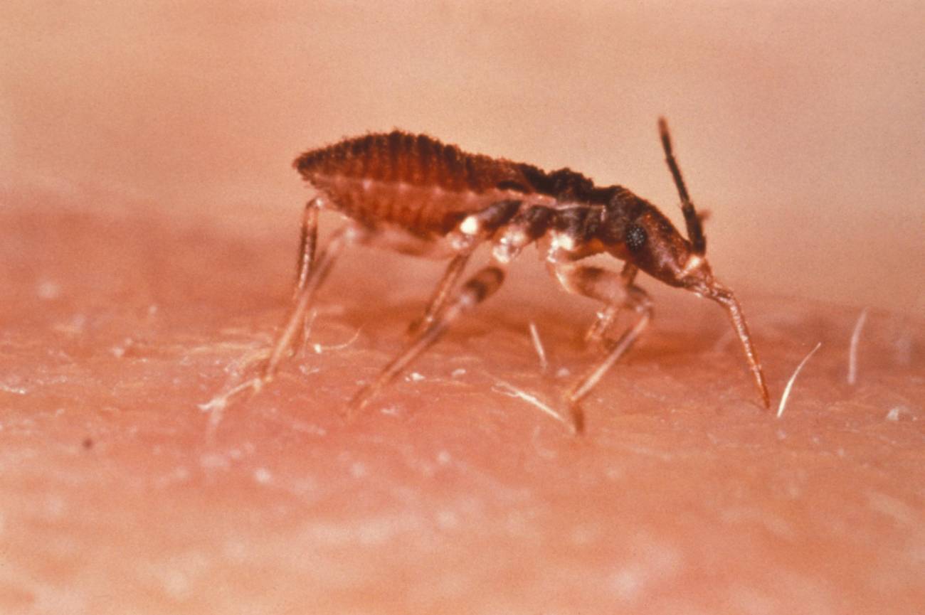 Según la Fundación Mundo Sano y el CRESIB, el mal de Chagas constituye un problema de salud pública en España