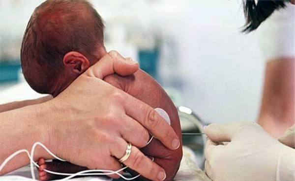 Ultrasonido y algoritmos para diagnosticar meningitis bacteriana en bebés