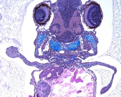 Embrión de pez cebra, que desarrolló miembros más parecidos a patas que a aletas después de ser manipulado para que produjera la proteina HoxD13. Imagen: Freitas et al., Developmental Cell. 
