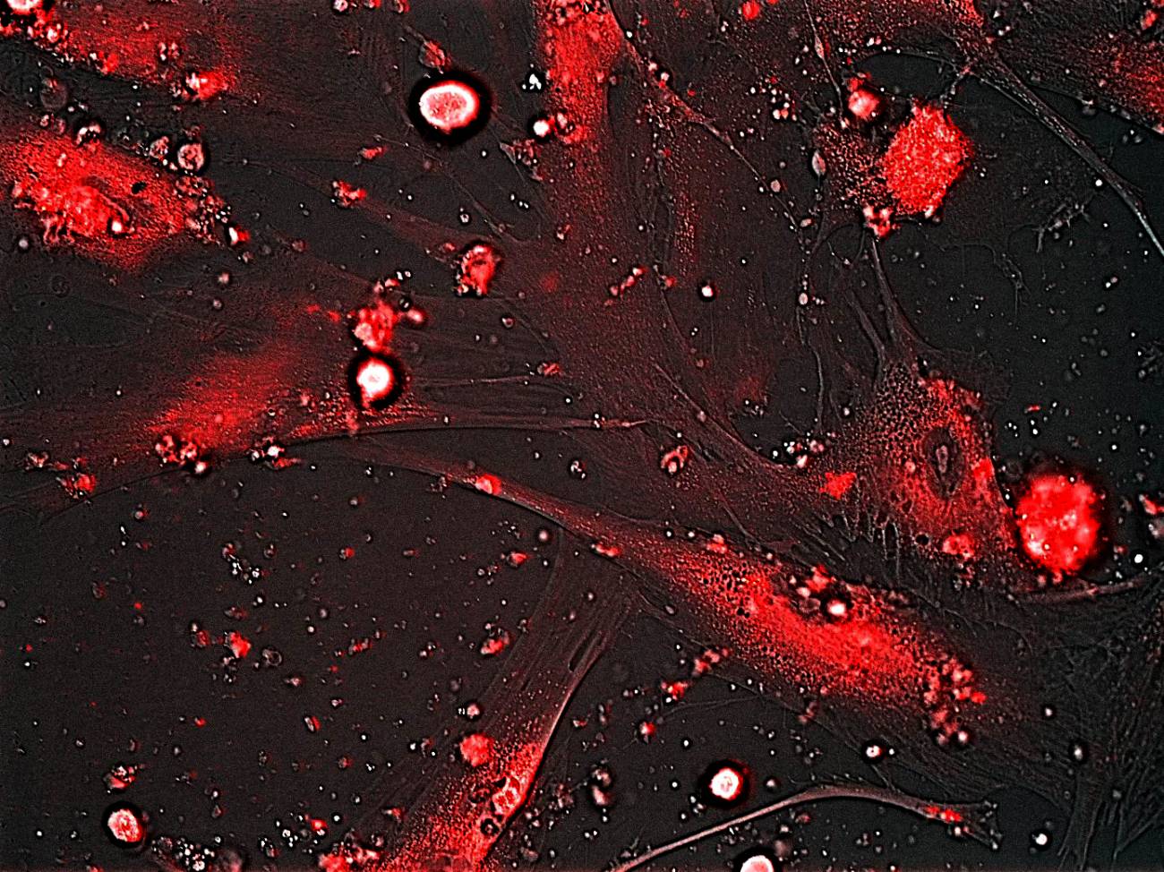 Liberación controlada de la molécula fluorescente rodamina en fibroblastos senescentes de pacientes con disqueratosis congénita. Imagen: CSIC. 