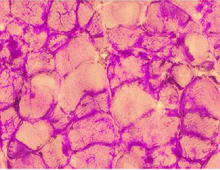 La enfermedad de McArdle provoca una falta de disponibilidad de glucosa que bloquea la actividad muscular. En la foto, corte del cerebro de un ratón afectado. Imagen: VHIR. 