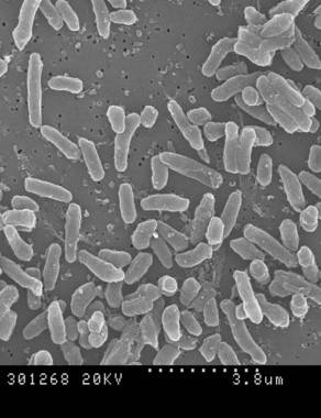 Una micobacteria podría sustituir el tratamiento actual del cáncer de vejiga