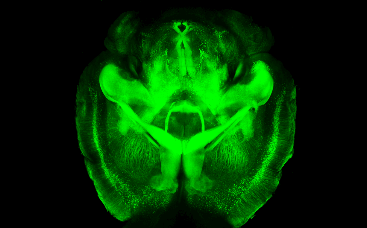 La nueva técnica permite observar un cerebro de ratón transparente. / K. Chung et al. (Univ. Stanford)