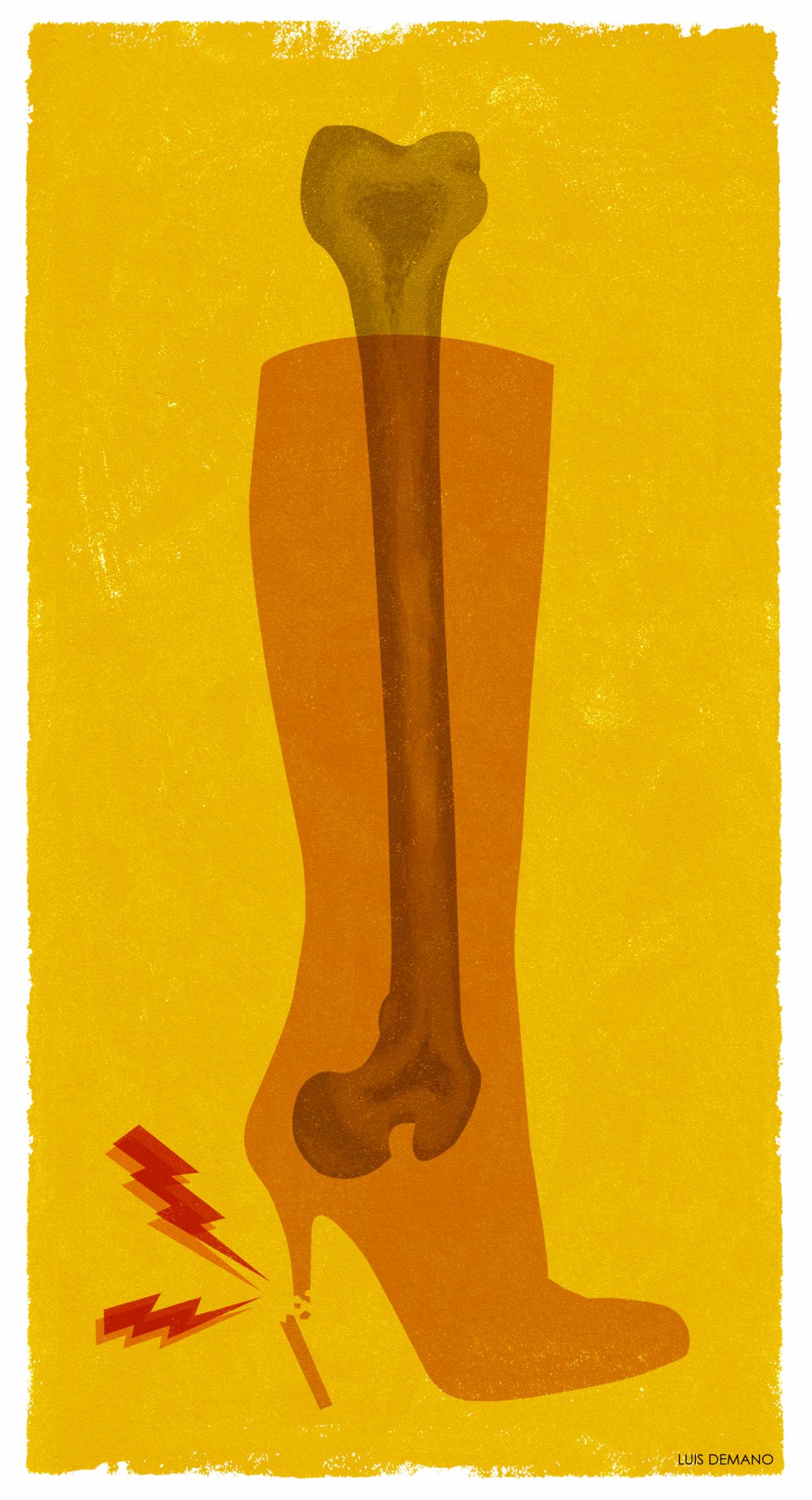 Día mundial de la osteoporosis