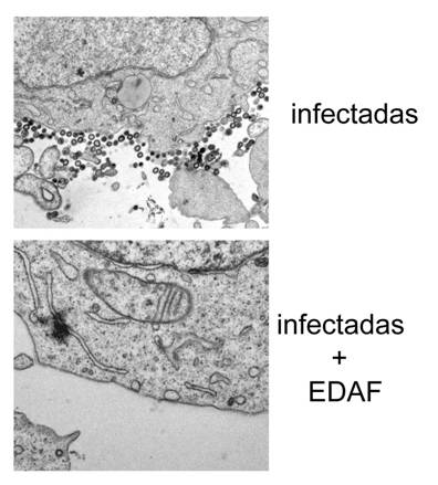 Células modificadas genéticamente que impiden la propagación del virus del SIDA