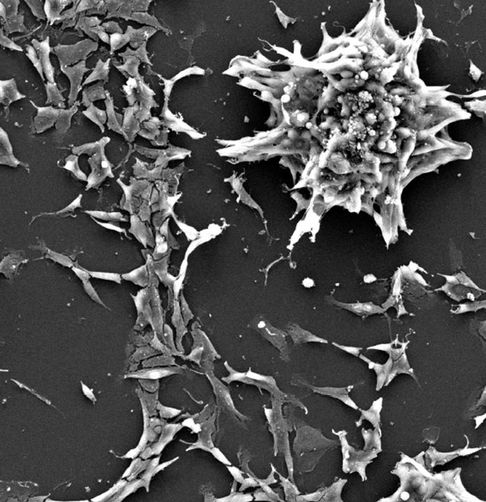 Descubren una conexión entre sobrecrecimiento y cáncer