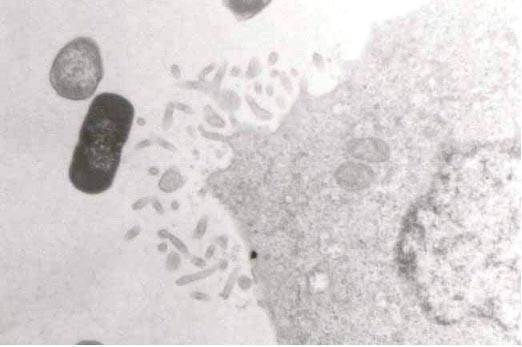 Lactobacillus gasseri