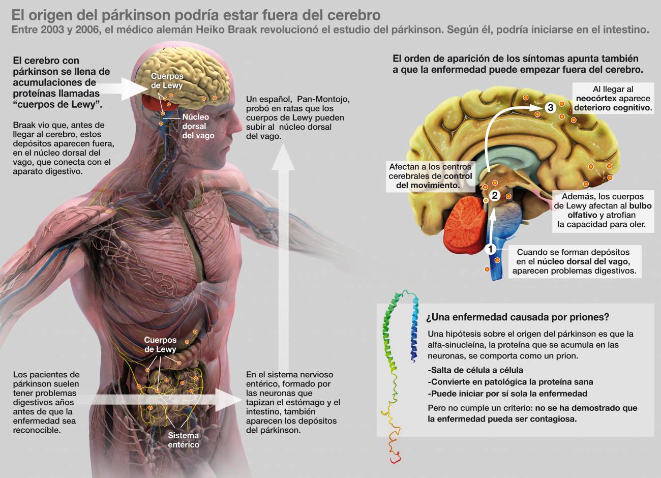 Priones que saltan del intestino al cerebro, la última explicación del párkinson