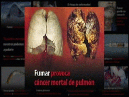 Cajetillas con fotografías impactantes sobre los riesgos del tabaco