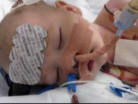 Curan la arritmia a un bebé británico de cuatro meses congelándole el corazón