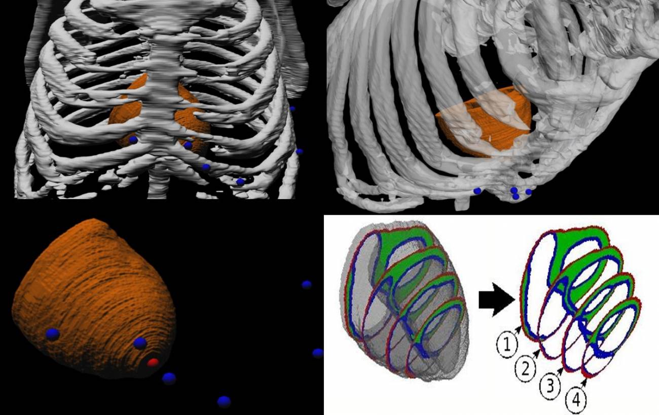 Desarrollan un corazón virtual para estudiar las causas de las arritmias cardiacas