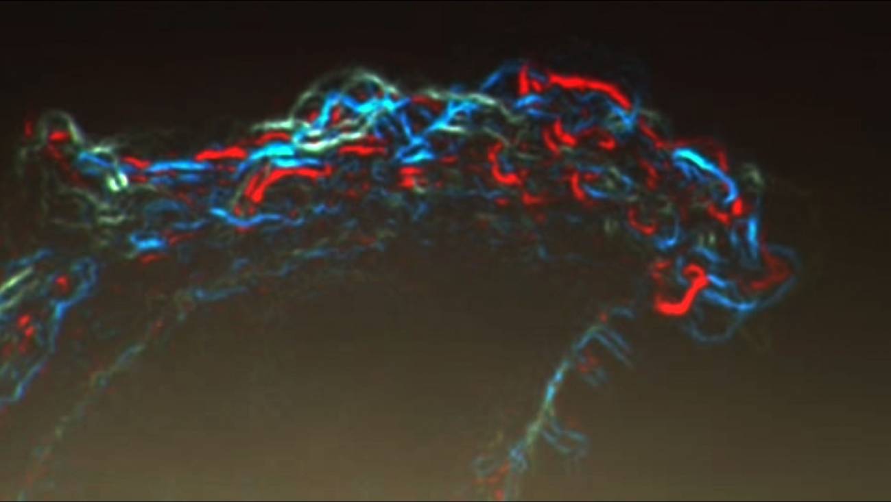 Descubren un mecanismo celular clave en el cáncer de mama