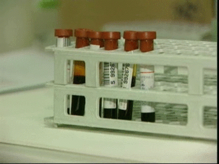 Detectar las células cancerígenas con un análisis de sangre