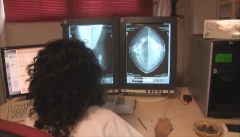 El cáncer de mama, una enfermedad crónica 