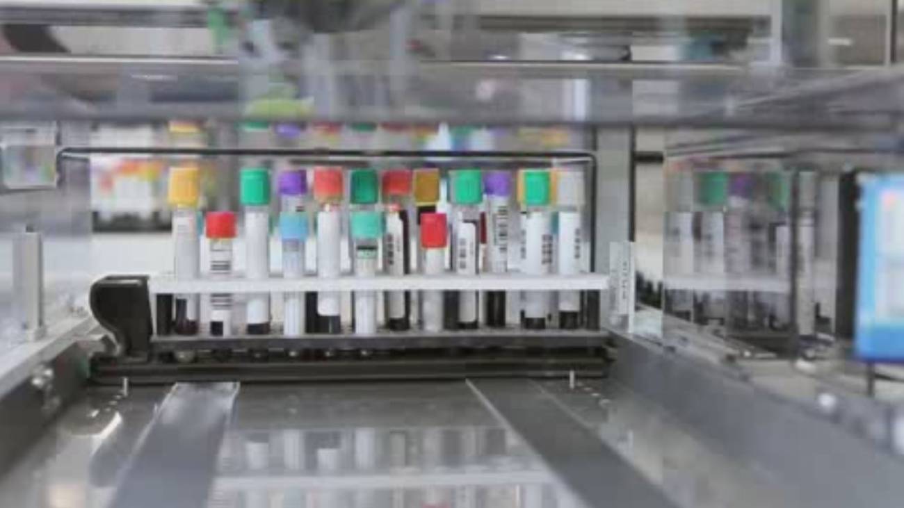 Laboratorio automatizado del Clinic.