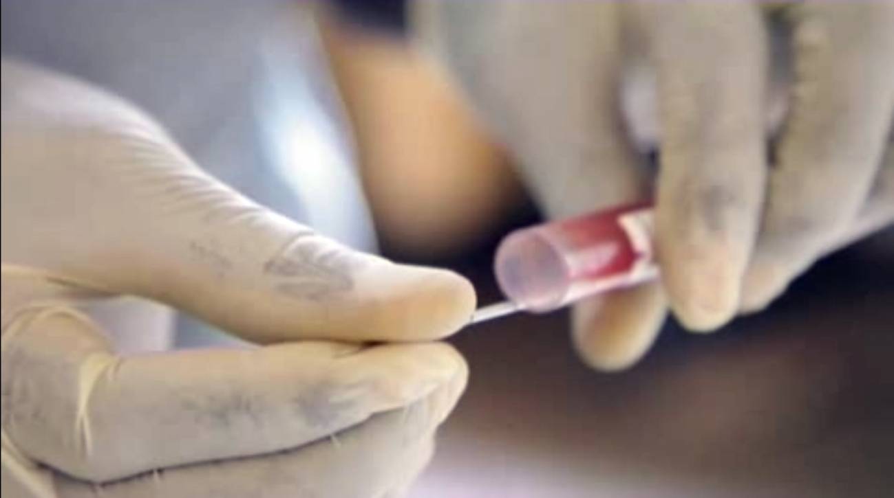 En África muere 3.500 personas de sida al día,
