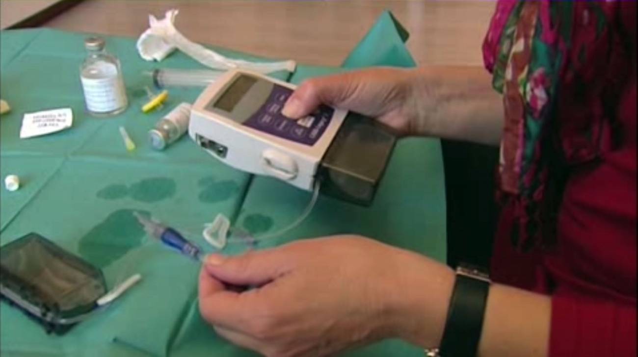 Paciente de hipertensión arterial pulmonar