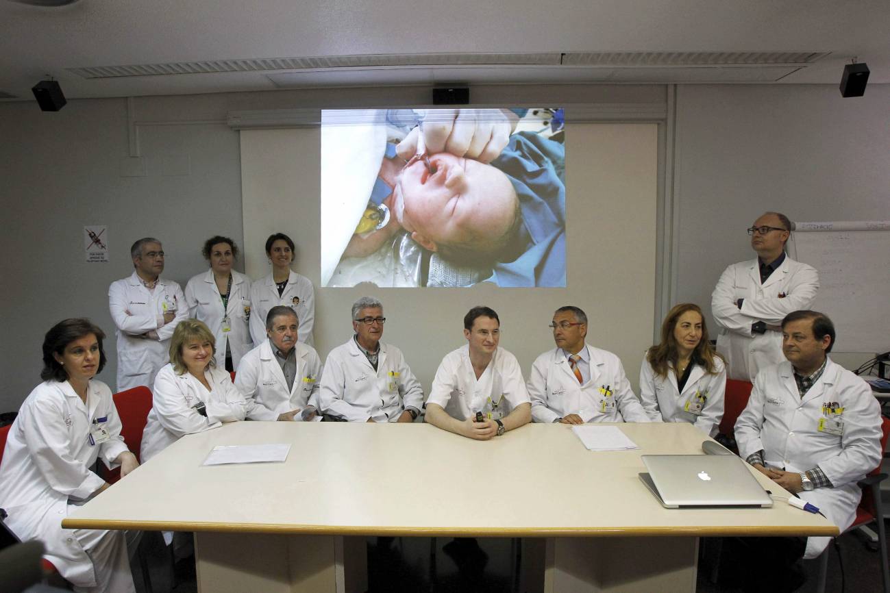 Extirpan un tumor facial a feto de 34 semanas