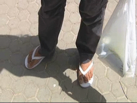 Ir en chanclas puede ser un riesgo