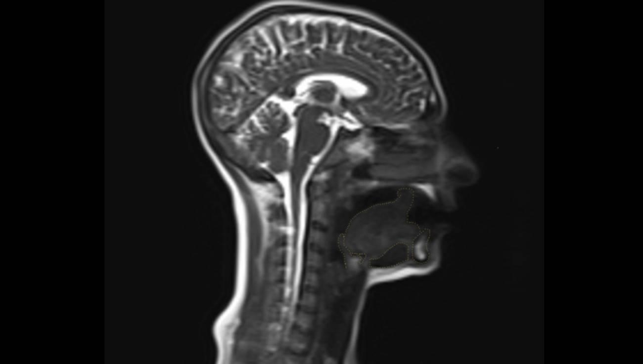La lengua en acción en 3D mientras se mueve al hablar