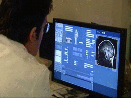 La obesidad podría aumentar el riesgo de padecer Alzheimer