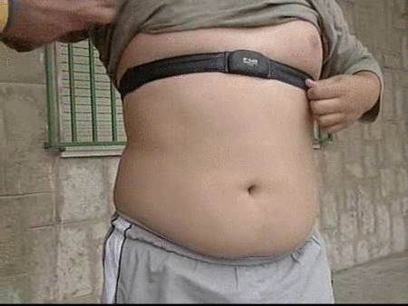 La obesidad, un problema en ascenso en los países desarrollados