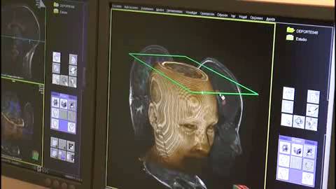 Un centro para ayudar a comprender el cerebro 
