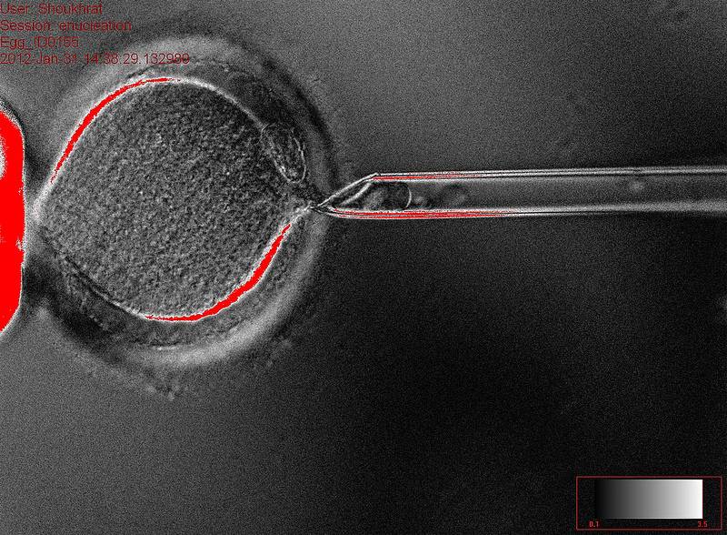 Un nuevo método para prevenir enfermedades mitocondriales