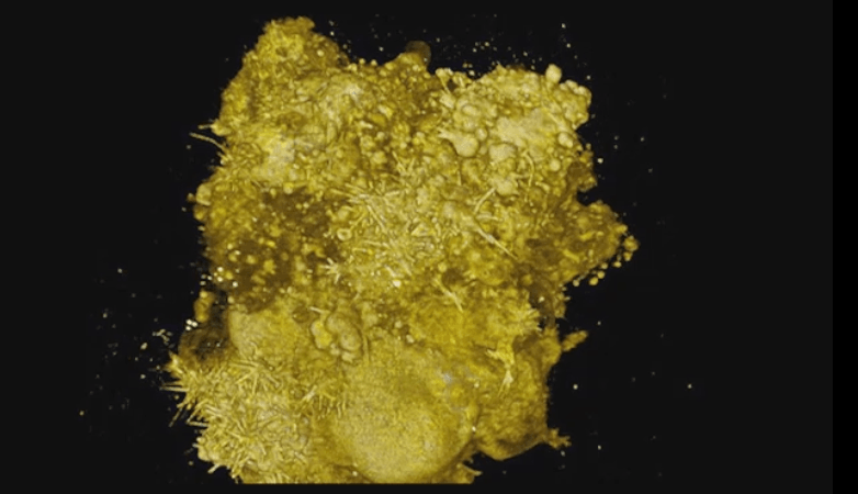  Un nuevo microscopio