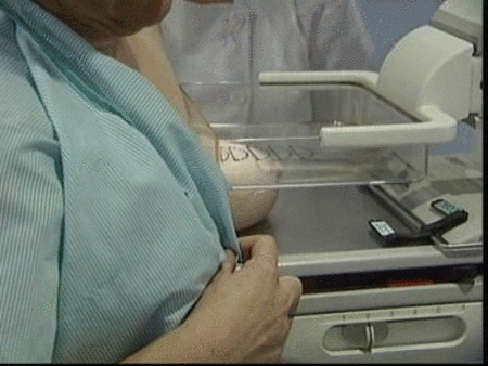 Una nueva esperanza para el cáncer de mama
