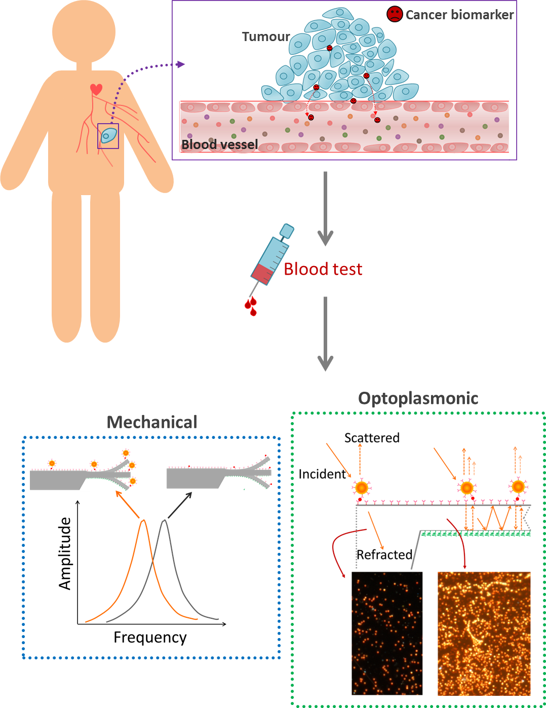 Nanosensores biológicos para la detección precoz del cáncer 