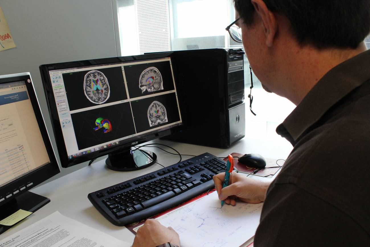 New, free online system able to analyse the images from a magnetic resonance of the brain