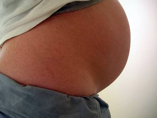 Pregnant woman