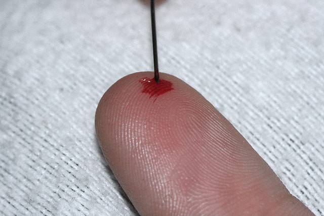 ¿A qué huele el dolor?